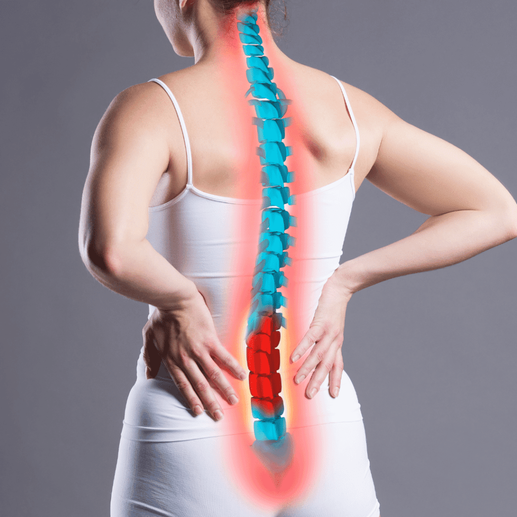 Lumbar Radiculopathy 1