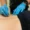 Dry Needling 1