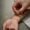 Joint and Nerve Related Issues