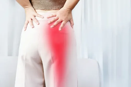 Piriformis Syndrome