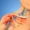 Left Brachial plexiopathy