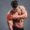 Left Brachial Plexiopathy involving Axillary Nerve
