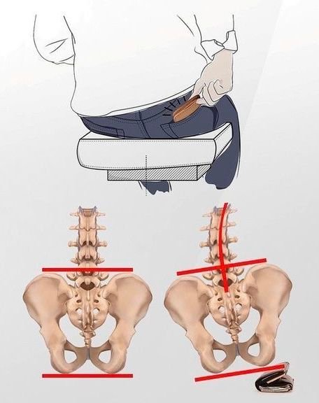 Fat Wallet Syndrome: