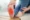 Plantar-fasciitis