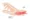 De Quervain's Tenosynovitis