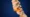 Spondylolisthesis