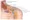 Thoracic Outlet Syndrome