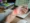 Carpal Tunnel Syndrome