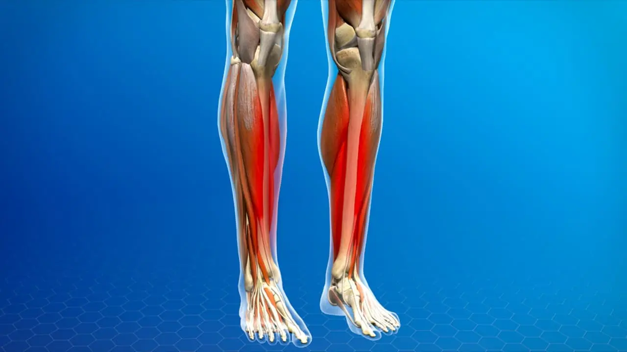 Shin Bone Pain