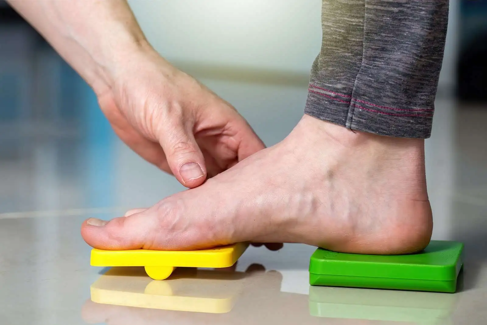 Flat Foot (Pes Planus)