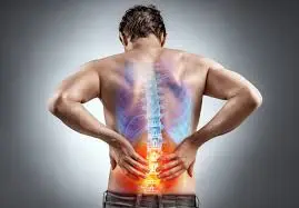 Lumbar Spondylosis