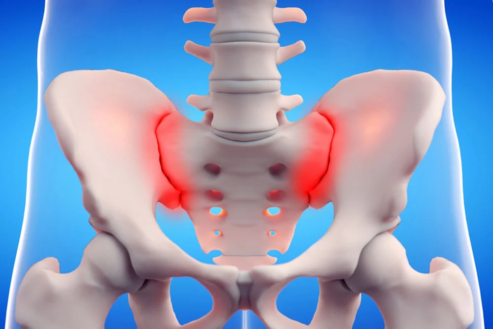 Sacroiliac Joint Dysfunction