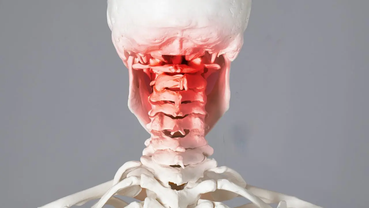 Cervicogenic Dizziness