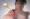 Parsonage-Turner Syndrome
