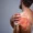 Quadrilateral Space Syndrome