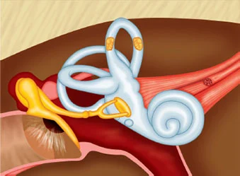 Superior Canal Dehiscence Syndrome