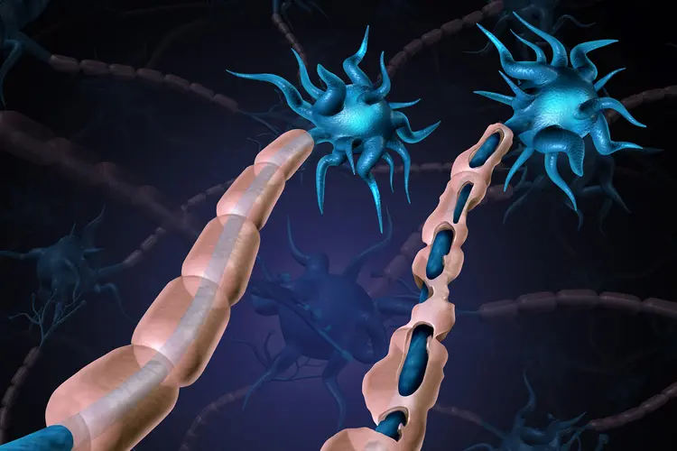 Guillain-Barré Syndrome