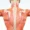 Myofascial Pain Syndrome