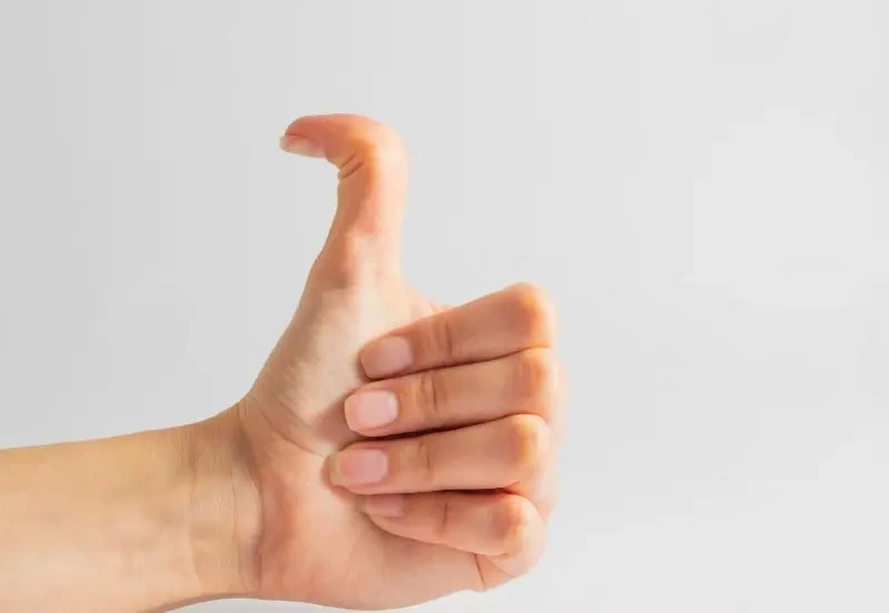 Hyper Extended Thumb