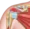 Acromioclavicular Bursitis