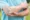 Fixed Flexion Deformity