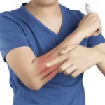 Forearm Flexor Strain