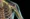 Sacral Plexus Injury