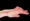 Claw Hand
