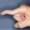 Swan Neck Deformity