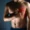 Pectoralis Major Strain