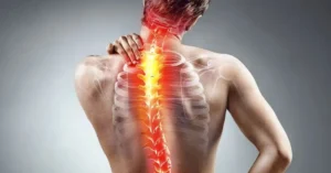 Referred Pain