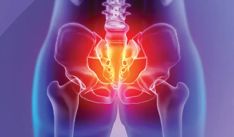 Chronic Pelvic Pain