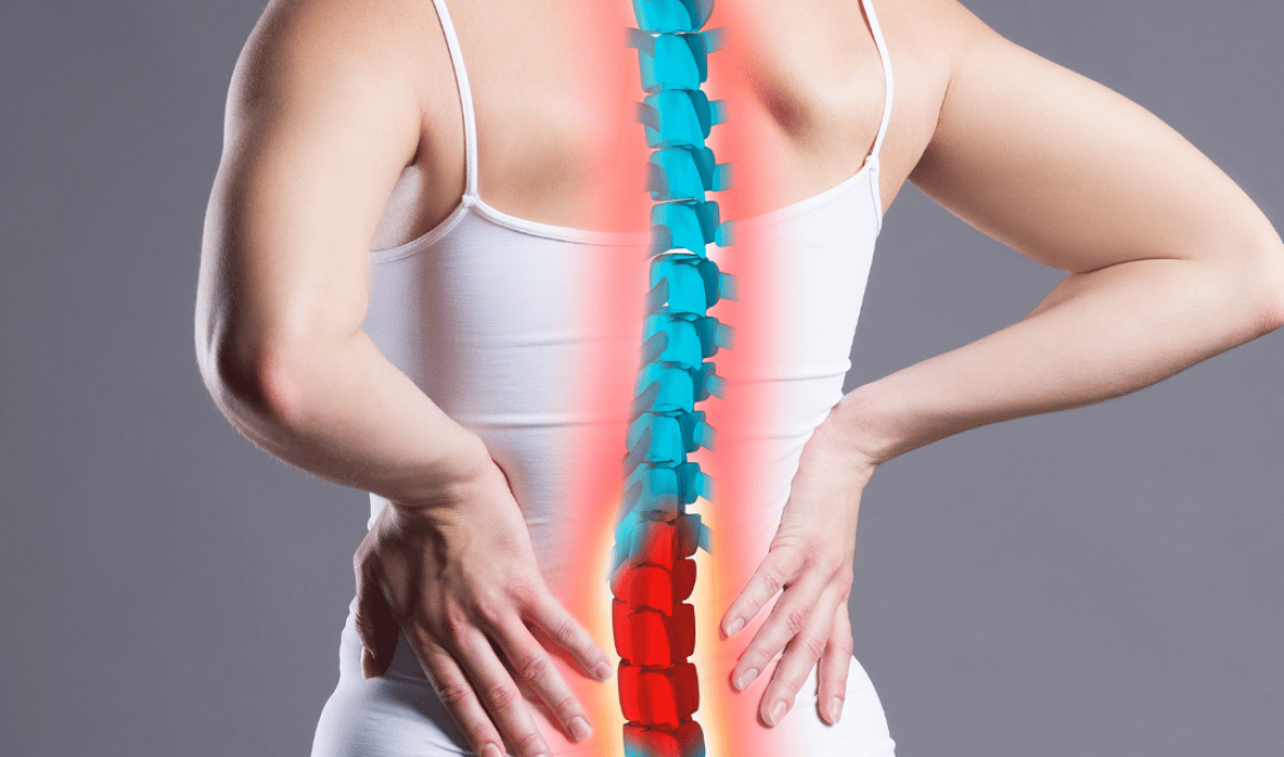 Lumbar Radiculopathy 1