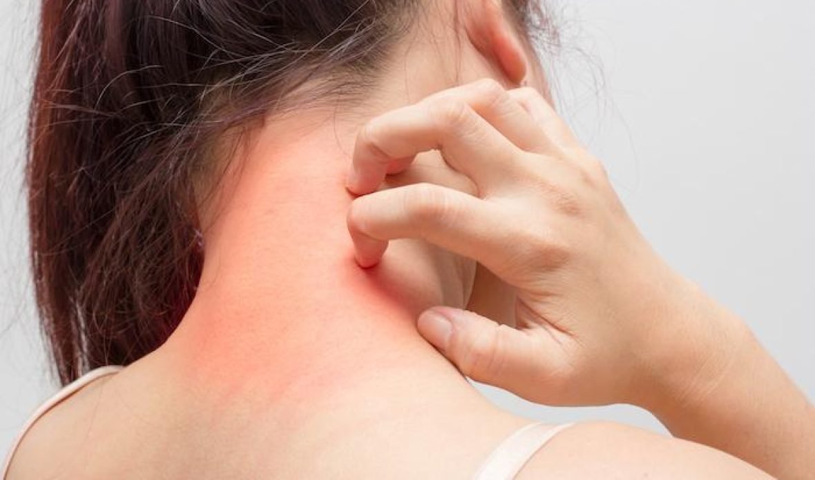 Postural Neck Pain (FHP )
